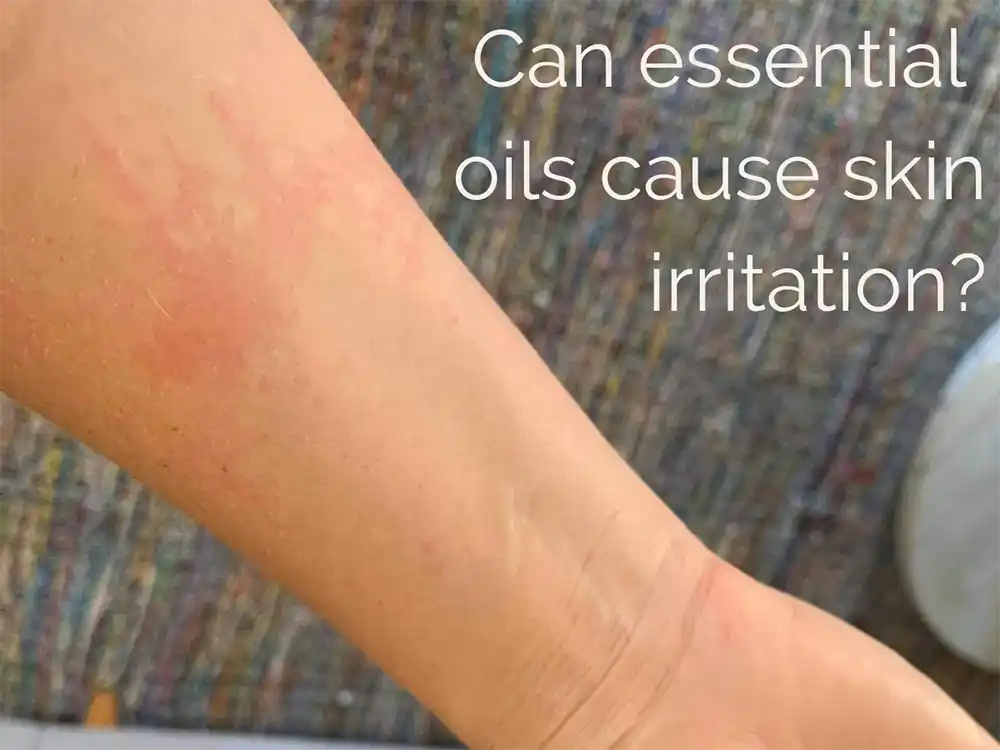 can essential oils cause skin irritation